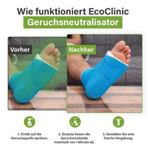 Voor-en-na-afbeelding van een voet in een blauw gipsverband, waarbij EcoClinic Ontgeurder wordt gebruikt om geur te verwijderen.